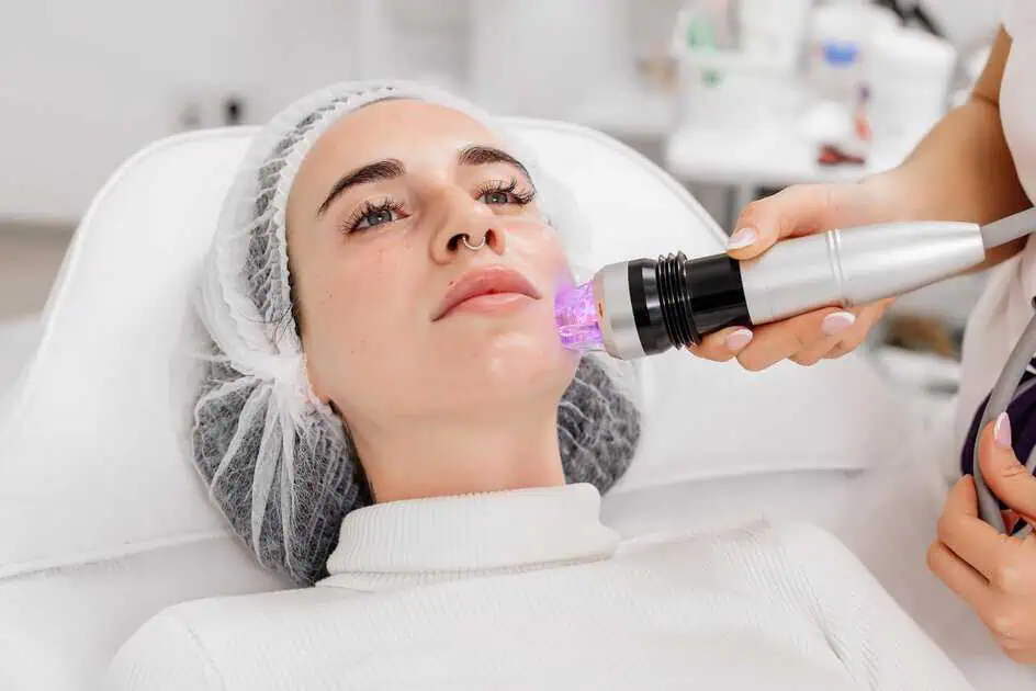 Microneedling Treatment in Sioux Falls, SD by NexGen Gynecology & Aesthetics