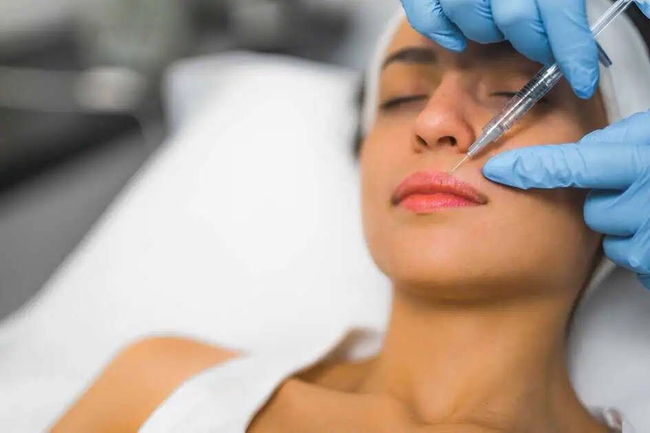 Botox lip flip procedure injecting botulinum toxin for lip enhancement