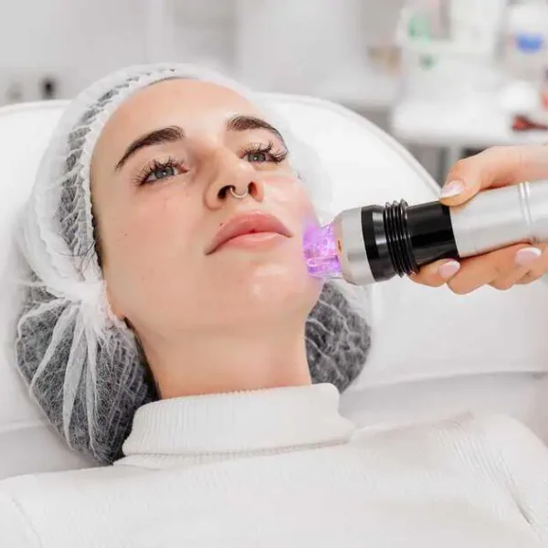 Microneedling Treatment in Sioux Falls, SD by NexGen Gynecology & Aesthetics