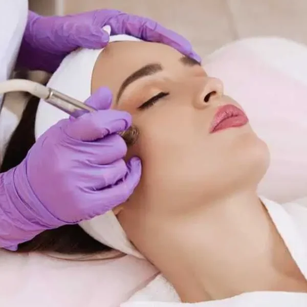 Woman receiving a microdermabrasion facial at a dermatology clinic in Sioux Falls, SD