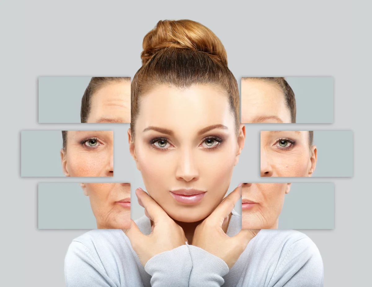 Woman’s face illustrating effects of Botox and Dysport wrinkle relaxers