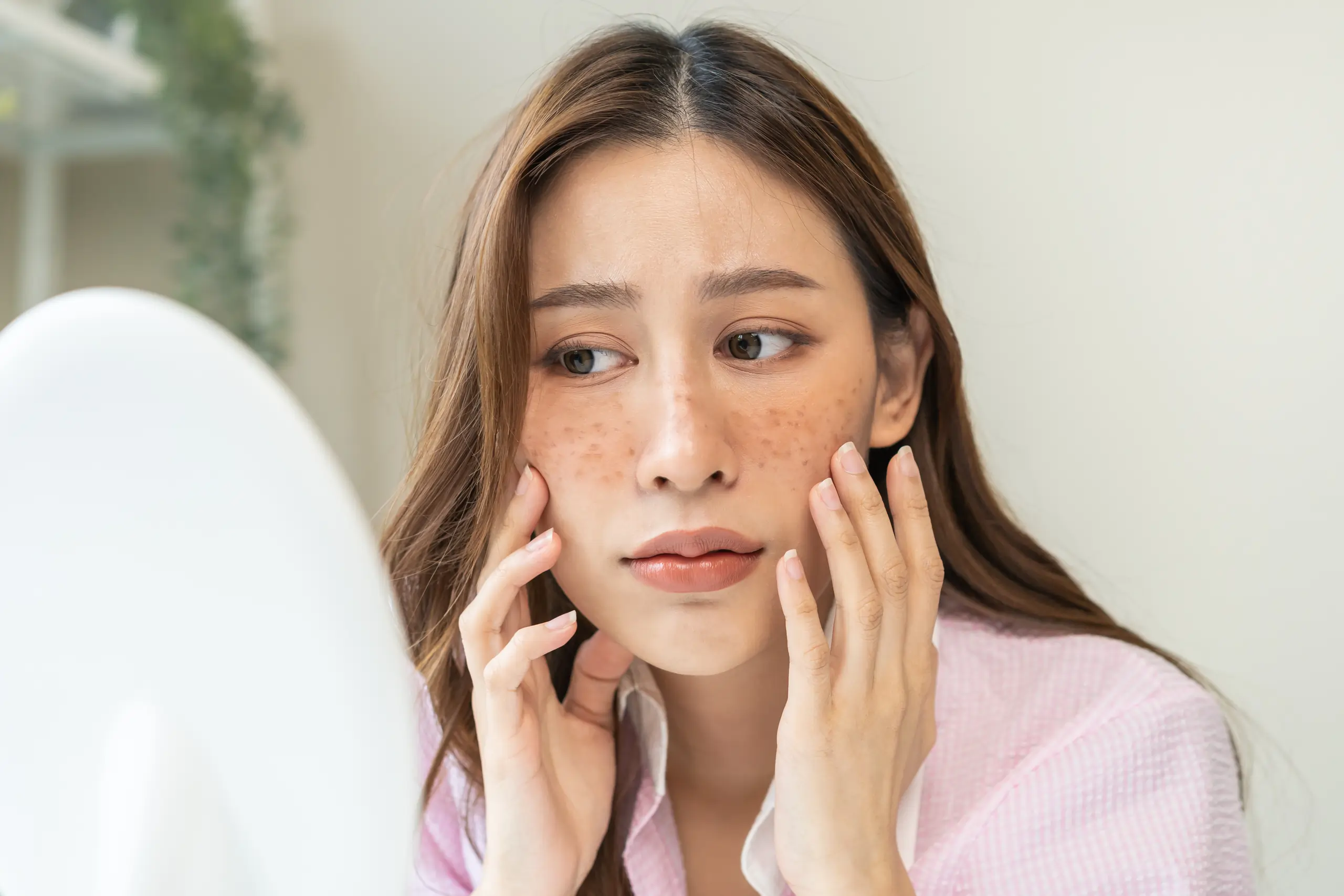 Hyperpigmentation treatment for clearer skin, Sioux Falls, SD clinic.