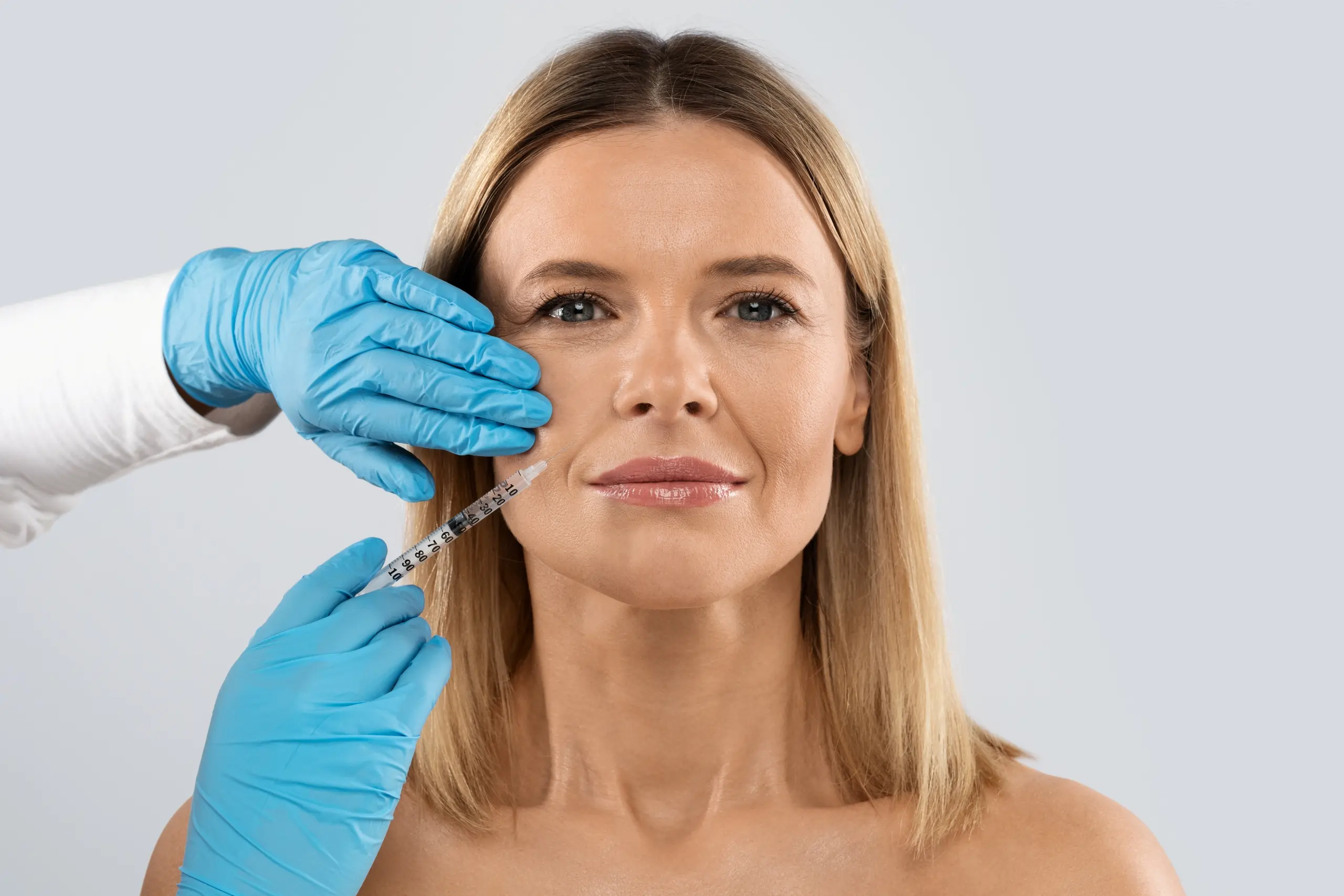 Nasolabial fold correction with dermal fillers, Sioux Falls, SD clinic.