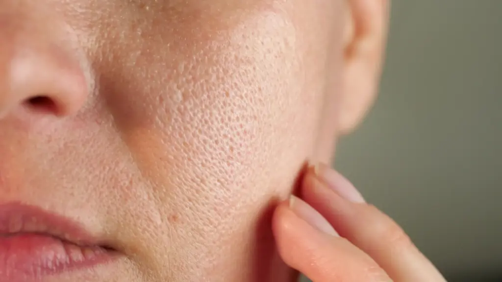 Minimize enlarged pores for refined texture at The Confidence Collective in Sioux Falls, SD.