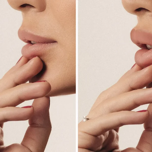 Woman showing her lips to illustrate lip flip and lip filler treatments for fuller, more defined lips